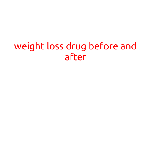 Weight Loss Drug: Before and After Results