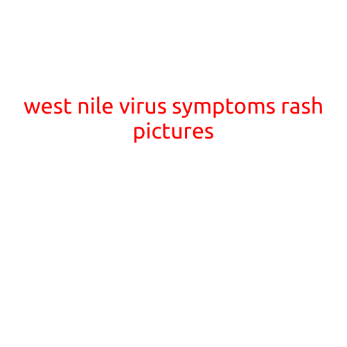 West Nile Virus Symptoms: Recognizing the Rash and Pictures